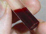 Fotografia de um tubo de ensaio com sangue.