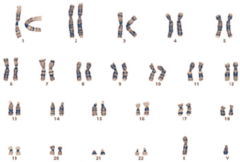 Os seres humanos têm 23 pares de cromossomas. O DNA dos machos (aqui representado) contém um cromossoma X e um cromossoma Y, enquanto que o DNA da fêmeas contém dois cromossomas X.