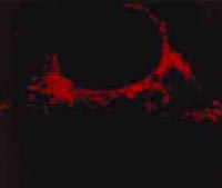 As mitocôndrias (marcadas com um corante vermelho) estão espalhadas pelo citoplasma desta célula cancerosa humana.