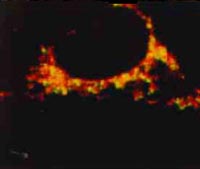 A sobreposição computorizada destas duas imagens da mesma célula mostra que as mitocôndrias e o seu DNA surgem em conjunto (regiões amarelas).