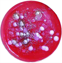 Cientistas do século XIX descobriram que as bactérias podem provocar doenças. A Bacillus anthracis (à esquerda) causa carbúnculo e a Vibrio cholerae (em baixo) causa cólera.