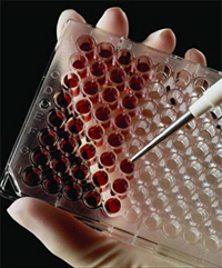 Fotografia de uma mão enluvada a segurar uma placa de PCR.